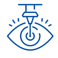 LASIK